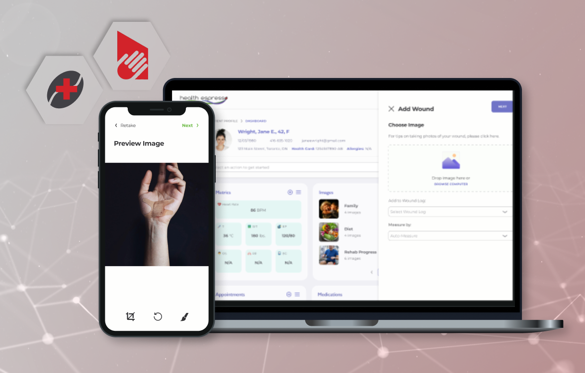 Health Espresso Partners with Wounds Canada to Change Wound Care in Canada 